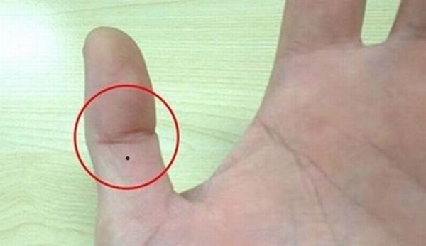 Xem bói tướng số nếu có nốt ruồi ở ngón tay cái
